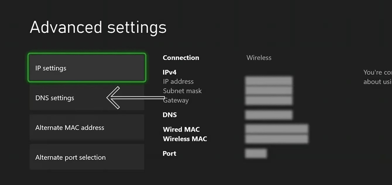 Xbox DNS Settings