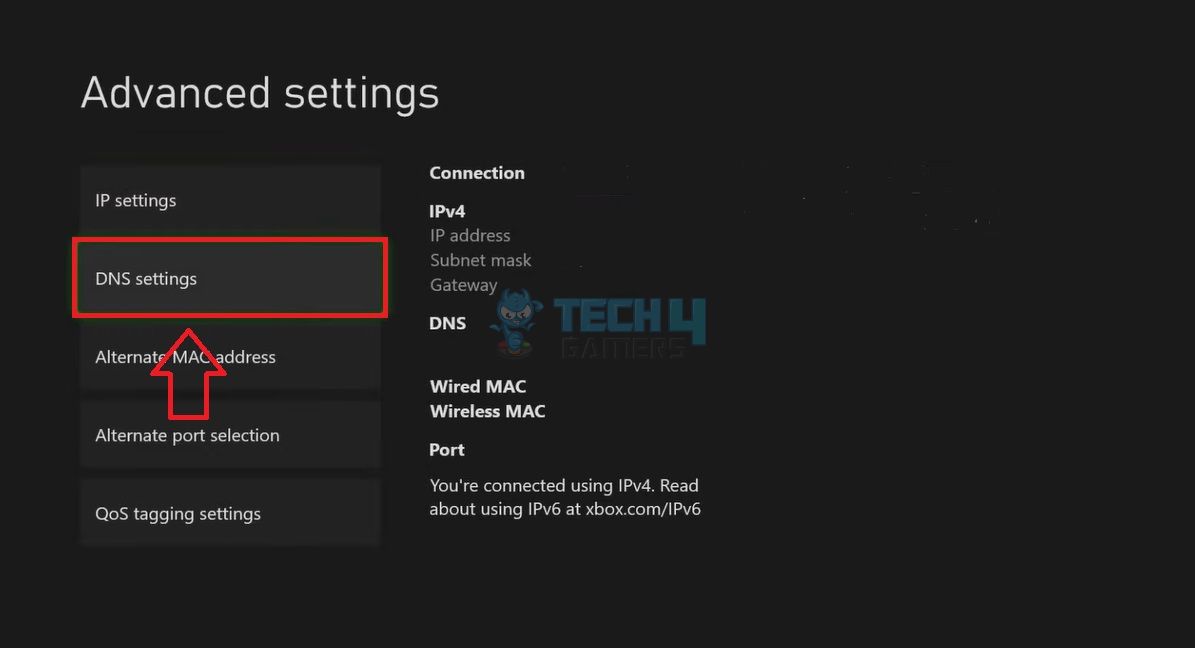 How To Change DNS On Xbox? [360, One, Series X/S] - Tech4Gamers